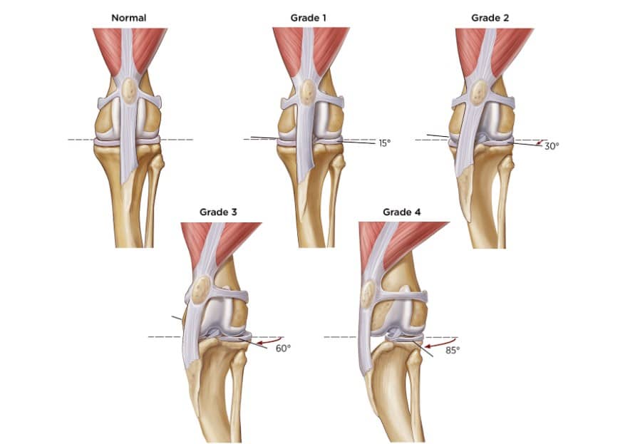 Canine Patellar Luxation: Causes, Grades, Symptoms, Treatment, and Prognosis