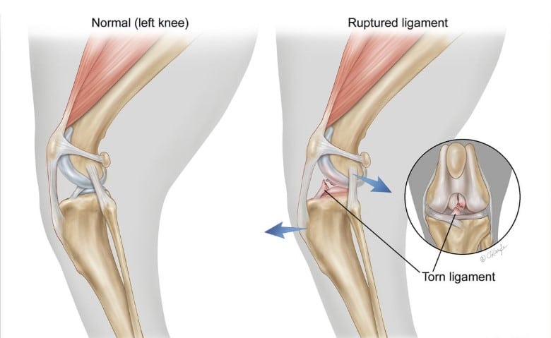 Canine Torn CCL (ACL)