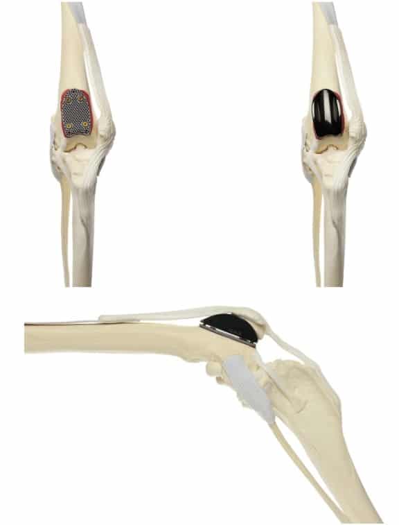 Canine Patellar Luxation: Causes, Grades, Symptoms, Treatment, and Prognosis Canine Patellar Luxation: Causes, Grades, Symptoms, Treatment, and Prognosis